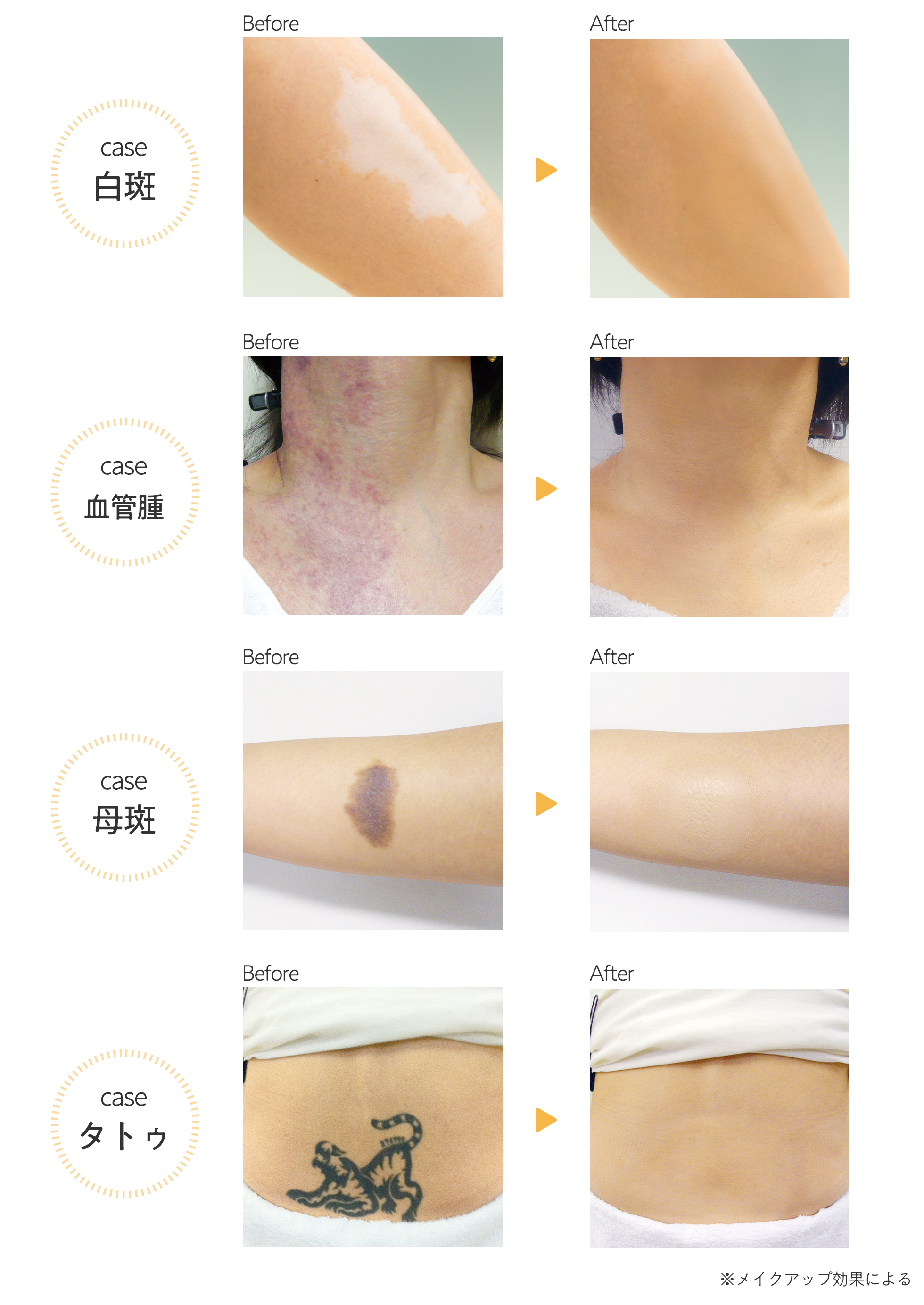 マーシュフィールド Sc ボディカバーファンデn 各 40g マーシュ フィールド株式会社